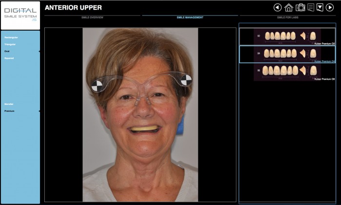 Schermata Digital Smile System che mostra il volto del paziente e la libreria di suggerimento di immagini della tomaia anteriore