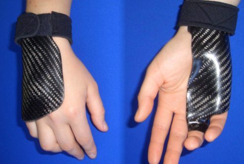 Mani che indossano un prototipo di prodotto medico