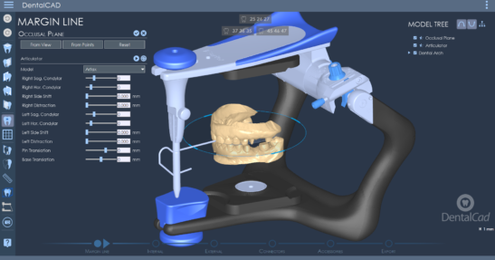 DentalCad 2019.2 showing virtual articulator