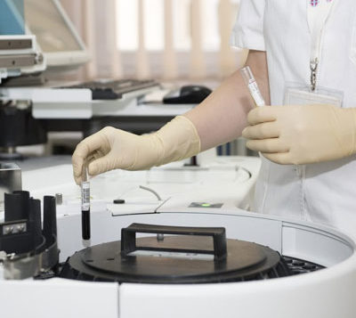 Medical laboratory blood sample research