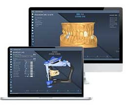 Laptops showing EGS DentalCad software