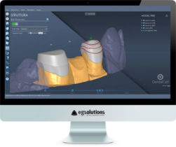 Monitor showing DentalCad 2017