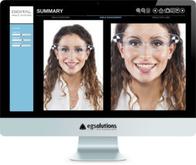 Monitor showing Smile Design Software