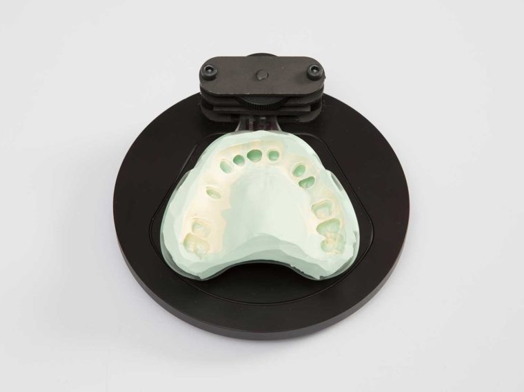 complete dental arch scanning