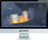 Monitor showing DentalCad 2017