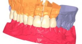 About EGSolutions - Dental 3D model 2006 Starts the development of 3D modules for the dental industry
